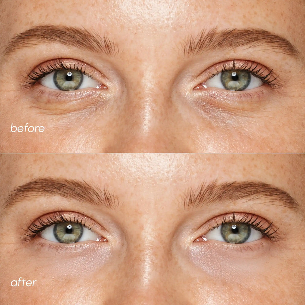 Pink Eye Patches for Puffy Eyes