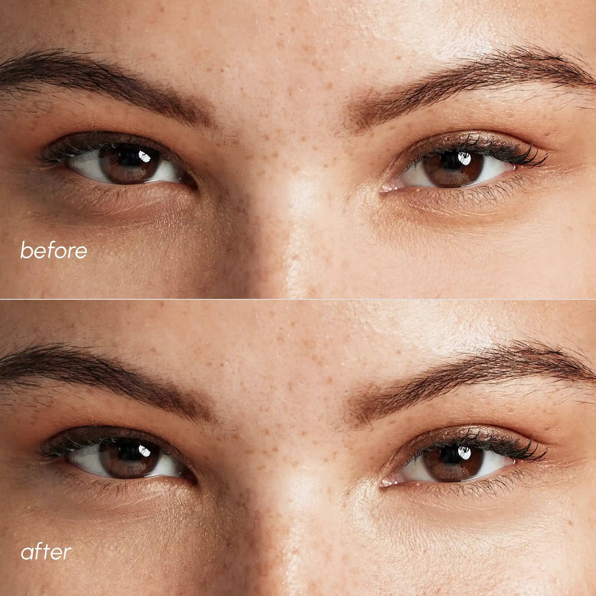 Pink Eye Patches for Puffy Eyes